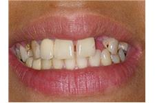 OC Dental Implants image 8