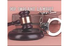 Hip Implant Lawsuit image 1