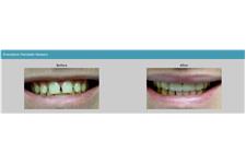 Smiley Dental & Orthodontics image 4