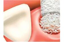 OC Dental Implants image 2
