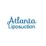 Atlanta Liposuction LLC image 1
