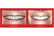 Cosmetic Dentistry Center of NYC image 3
