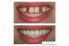 Pennsauken Family Dental image 3