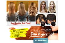 Hair Vitality Trials image 5