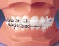 Exeter Orthodontics Reading image 1