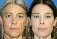 Carmel Valley Facial Plastic Surgery image 3