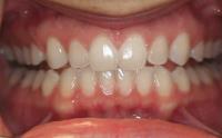 Gateway Dental Care image 4