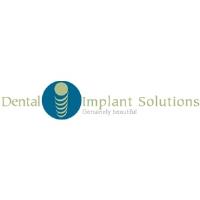 Dental Implant Solutions image 1