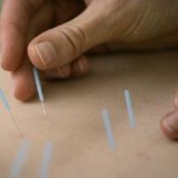 Acupuncture & Alternative Health Care image 1