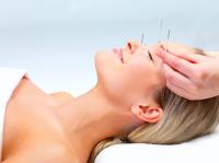 Perfect Union Mind & Body Acupuncture image 7