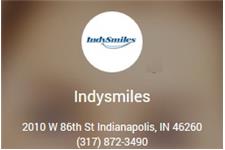 Indy Smiles image 1