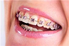 Orthodontic Experts  image 4