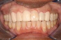 Smile Dental Clinics image 2