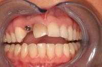 Smile Dental Clinics image 3