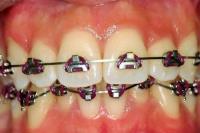 Smile Dental Clinics image 6