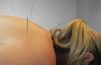 River City Wellness & Acupuncture image 2