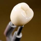 Bluffton Dental Care image 5