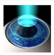 The Diamond Vision Laser Center of New Paltz image 1