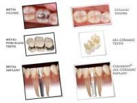 Natural Dentist Associates image 4