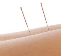 Classical Five Element Acupuncture image 2