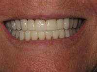 Aesthetic Family Dentistry image 8