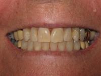 Aesthetic Family Dentistry image 7