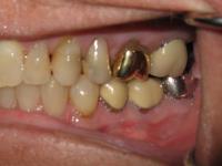 Aesthetic Family Dentistry image 10