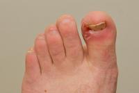 European Foot & Ankle Clinic image 8