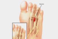 European Foot & Ankle Clinic image 11