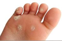 European Foot & Ankle Clinic image 13