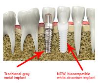 Rockville Dental Implant Center image 4