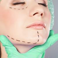 Eye Plastic Surgery Associates image 2