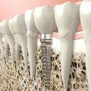 Mesa Dental Implants & Periodontics logo