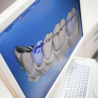Mesa Dental Implants & Periodontics image 2