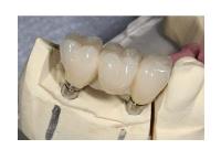Buckhead Dental Partners image 6