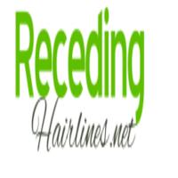 Receding  Hairlines image 1