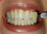 Ivory Dental Group image 4
