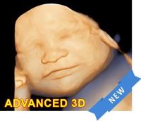 Prenatal Universe Ultrasound image 4