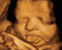 Picture Perfect 3D/4D Ultrasound Imaging image 2