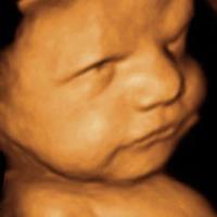 Picture Perfect 3D/4D Ultrasound Imaging image 3