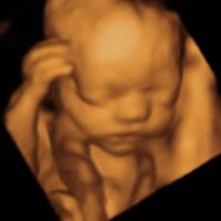 Picture Perfect 3D/4D Ultrasound Imaging image 4