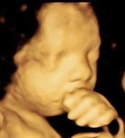Baby Impressions 3D / 4D Ultrasound Center image 2