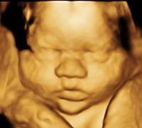 Baby Impressions 3D / 4D Ultrasound Center image 3