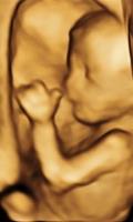 Baby Impressions 3D / 4D Ultrasound Center image 4