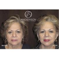 Anderson Plastic Surgery & Med Spa image 3