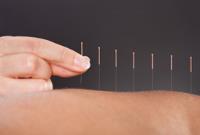 MW Acupuncture image 1