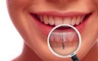 Melancon Family Dentistry image 1