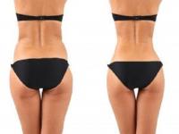 Great Price Body Sculpting and Aesthetics image 10