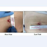 Physician Wound Care image 4