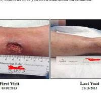 Physician Wound Care image 5